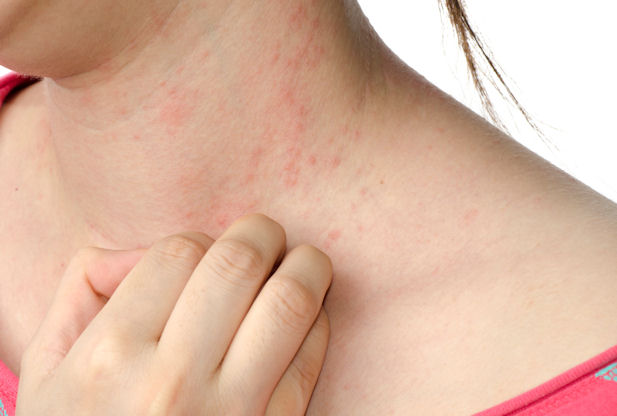 Skin Allergy Treatment in Himachal