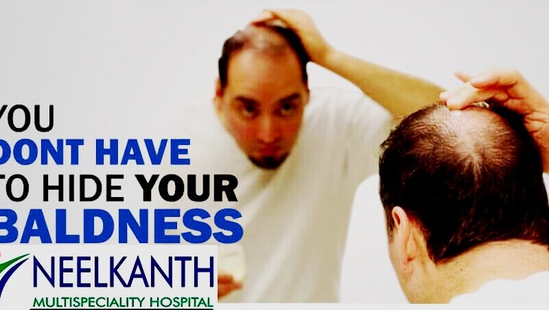 Hair Transplant Procedure- Average Cost, Expected Results & More.