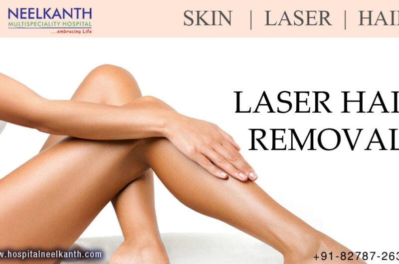 Benefits of Laser Treatment for Body Hair & Facial Hair Removal