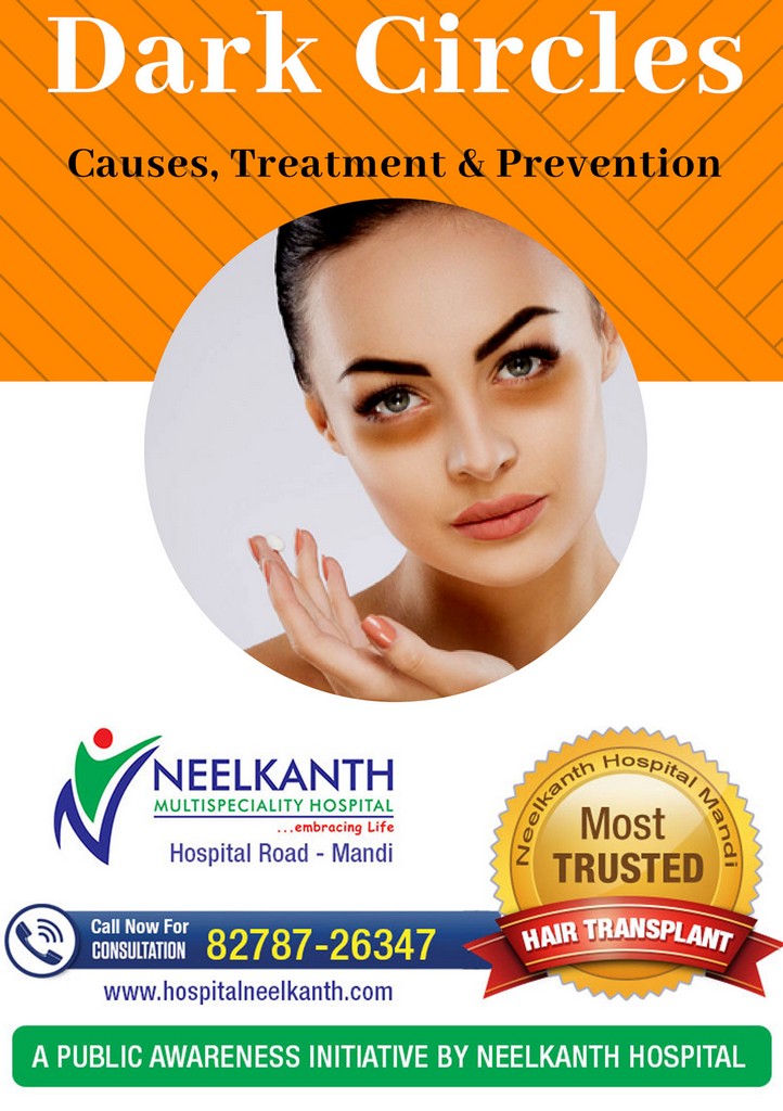 Dark Circles (Periorbital Pigmentation) – Causes, Treatment & Prevention
