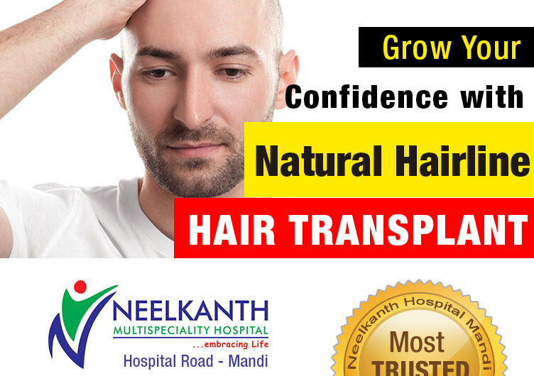 Receding Hairline – Signs, Causes and Natural Hairline Treatment for Men