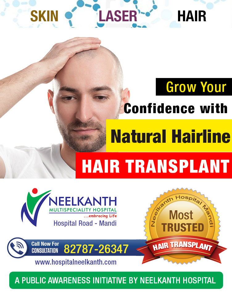 Receding Hairline – Signs, Causes and Natural Hairline Treatment for Men