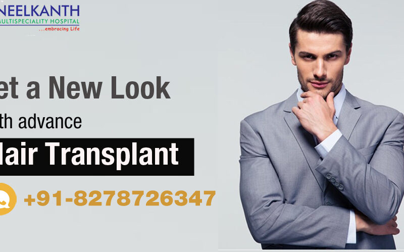 Hair Density Hair Transplant – Facts, Steps & Surgical Process