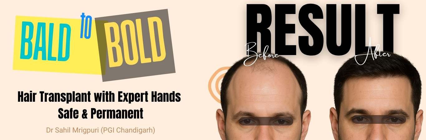 neelkanth hair transplant